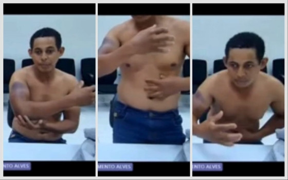 Assaltante confessa participação em roubo ao Sicredi de Brasnorte e denuncia tortura policial durante audiência de custódia