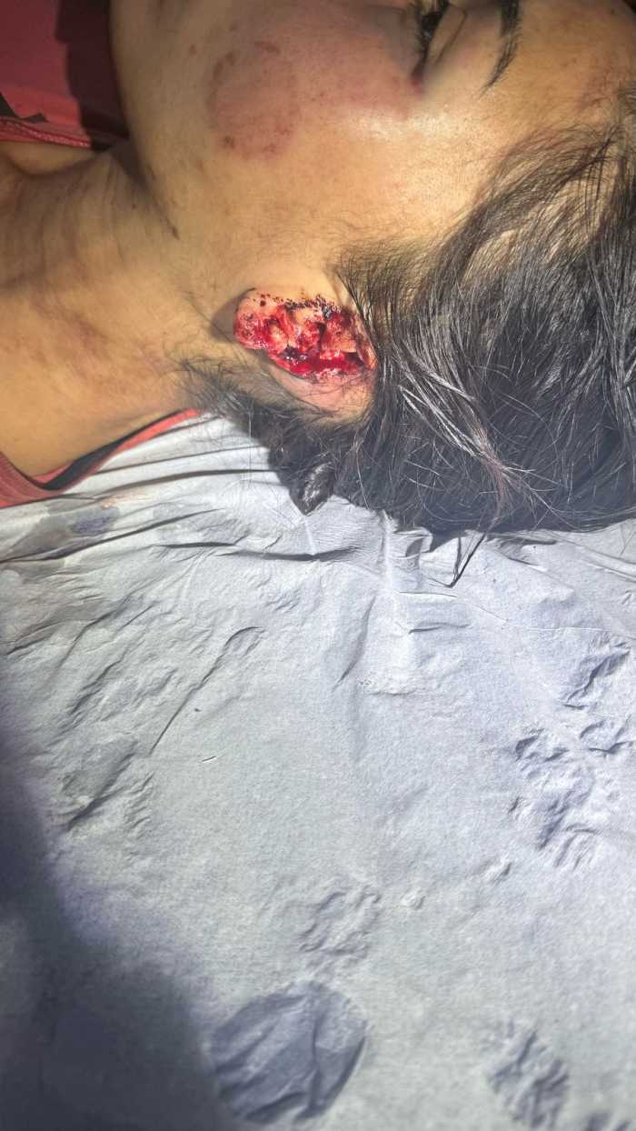 Relembrando um caso chocante de violência em Primavera do Leste: o grito urgente do Agosto Lilás