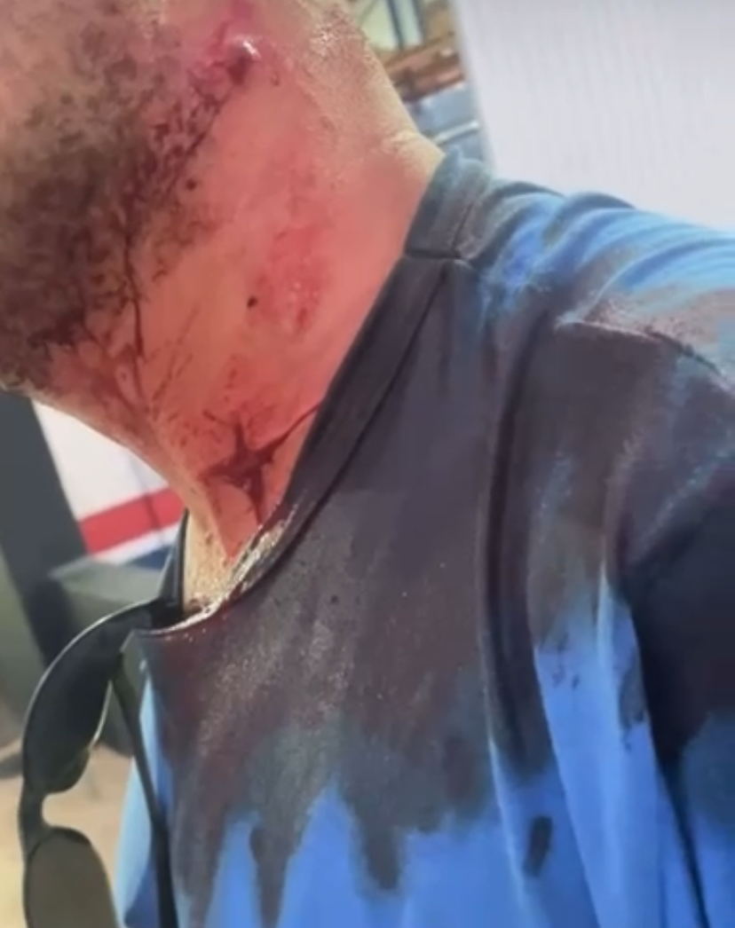 Tentativa de homicídio é registrada na região central de Primavera do Leste