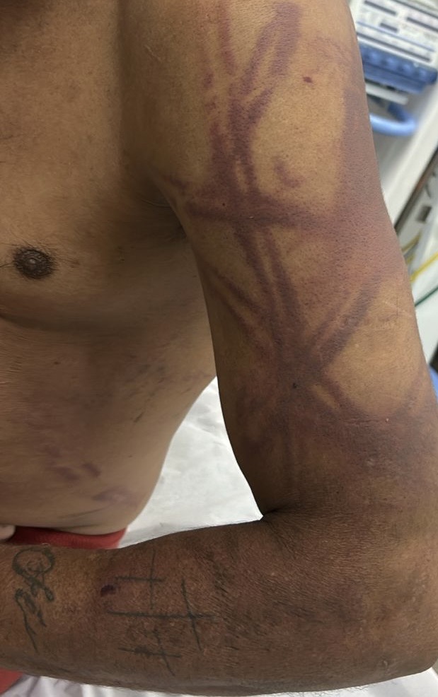 Seis são presos após Polícia Militar impedir “salve” e resgatar homem torturado em Primavera do Leste: homem torturado tinha mandado de prisão por homicídio 